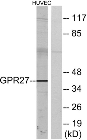 Western blot analysis of lysates from HUVEC cells, using GPR27 Antibody. The lane on the right is blocked with the synthesized peptide.
