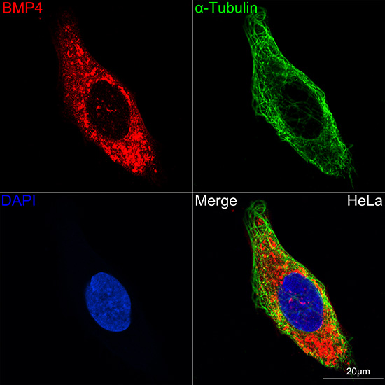 Immunohistochemistry analysis of paraffin-embedded Human colon using BMP4 Rabbit mAb at dilution of 1:100 (40x lens). Microwave antigen retrieval performed with 0.01M PBS Buffer (pH 7.2) prior to IHC staining.