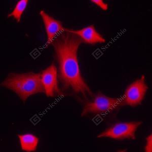 ICC analysis of beta Tubulinred.Sample: C6, were fixed in pre-cooled methanol 10 minutes.Blocking buffer: 3% BSA in PBS, RT, 30min.Primary antibody: 1: 100, 4℃ overnight.Secondary antibody: Cy3 conjugated Goat Anti-Rabbit IgG , 1: 300, RT, 1h.