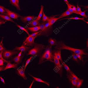 ICC analysis of beta Tubulinred.Sample: C6, were fixed in pre-cooled methanol 10 minutes.Blocking buffer: 3% BSA in PBS, RT, 30min.Primary antibody: 1: 300, 4℃ overnight.Secondary antibody: Cy3 conjugated Goat Anti-Rabbit IgG , 1: 300, RT, 1h.