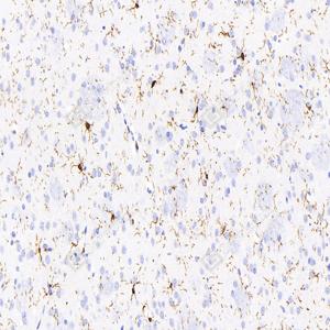 IHC analysis of Iba1.Sample: Rat brain, 4% PFA 12-24h.Antigen retrieval: Citrate buffer , 98℃, 20 min.Primary antibody: 1: 2000, 4℃ overnight.Secondary antibody: HRP conjugated Goat Anti-Mouse lgG , 1: 200, RT, 1h.