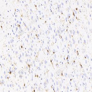 IHC analysis of Iba1.Sample: Rat brain, 4% PFA 12-24h.Antigen retrieval: Citrate buffer , 98℃, 20 min.Primary antibody: 1: 2000, 4℃ overnight.Secondary antibody: HRP conjugated Goat Anti-Mouse lgG , 1: 200, RT, 1h.