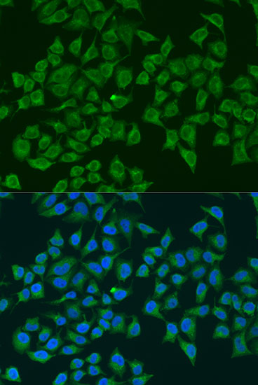 Immunohistochemistry analysis of paraffin-embedded Mouse kidney using iNOS Rabbit pAb at dilution of 1:100 (40x lens). Microwave antigen retrieval performed with 0.01M Tris/EDTA Buffer (pH 9.0) prior to IHC staining.