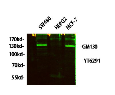 Western blot analysis of lysates from HT-29, NIH/3T3, and HepG2 cells, primary antibody was diluted at 1:1000, 4° over night, secondary antibody was diluted at 1:10000, 37° 1hour.