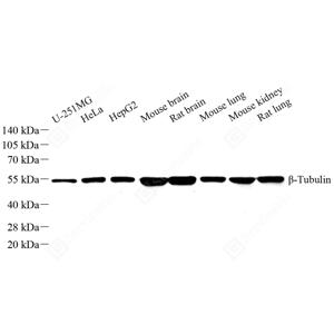 WB analysis of beta Tubulin.Sample: Protein treated by RIPA Lysis Buffer .Blocking buffer: 3% Nonfat dry milk in TBST, RT, 1h.Primary antibody: 1: 1000, 4℃ overnight.Secondary antibody: HRP conjugated Goat Anti-Mouse lgG , 1: 5000, RT, 1h.