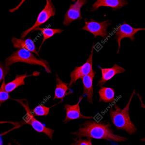 ICC analysis of beta Tubulinred.Sample: HeLa, 4% PFA 20min.Blocking buffer: 3% BSA in PBS, RT, 30min.Primary antibody: 1: 1000, 4℃ overnight.Secondary antibody: Cy3 conjugated Goat Anti-Mouse IgG , 1: 300, RT, 1h.