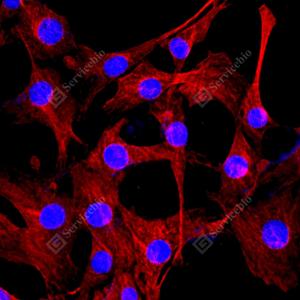 ICC analysis of beta Tubulinred.Sample: NIH3T3, 4% PFA 20min.Blocking buffer: 3% BSA in PBS, RT, 30min.Primary antibody: 1: 1000, 4℃ overnight.Secondary antibody: Cy3 conjugated Goat Anti-Mouse IgG , 1: 300, RT, 1h.