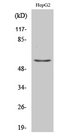Western Blot analysis of various cells using TH Polyclonal Antibody