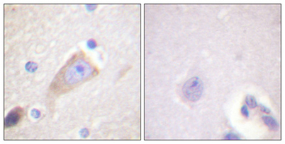 Immunohistochemical analysis of paraffin-embedded Human brain. Antibody was diluted at 1:100(4° overnight). High-pressure and temperature Tris-EDTA,pH8.0 was used for antigen retrieval. Negetive contrl (right) obtaned from antibody was pre-absorbed by i