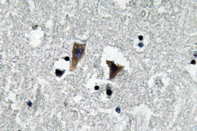 Immunohistochemistry analysis of MAO-A antibody in paraffin-embedded human brain tissue.