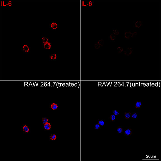 Confocal imaging of RAW 264.7 cells (treated with LPS and BFA) and RAW 264.7 cells (untreated) using IL-6 Rabbit PAb ( dilution 1:200) followed by a further incubation with Cy3-conjugated Goat Anti-Rabbit IgG (H+L) (AS007, dilution 1:500) (Red). DAPI was used for nuclear staining (Blue). Objective: 100x.