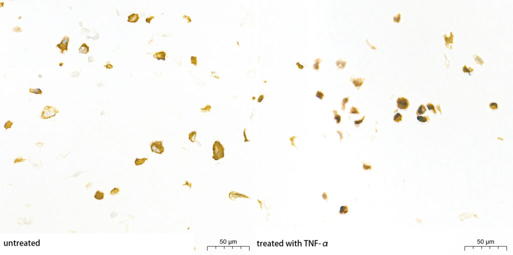 Immunohistochemistry analysis of paraffin-embedded HT-1080 cell lines(untreated and treated with TNF-α) using [KO Validated] NF-kB p65/RelA Rabbit mAb at a dilution of 1:3000 (40x lens). High pressure antigen retrieval performed with 0.01M Tris-EDTA Buffer (pH 9.0) prior to IHC staining.