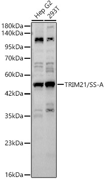Western blot analysis of various lysates using TRIM21/SS-A Rabbit pAb at 1:1000 dilution. Secondary antibody: HRP-conjugated Goat anti-Rabbit IgG (H+L)at 1:10000 dilution. Lysates / proteins: 25 μg per lane. Blocking buffer: 3 % nonfat dry milk in TBST. Detection: ECL West Pico Plus. Exposure time: 90s.
