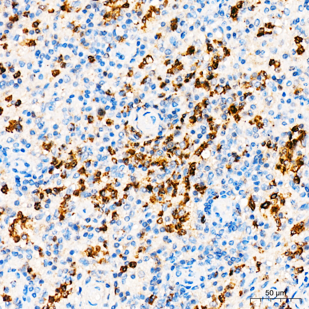 Immunohistochemistry analysis of paraffin-embedded Human spleen tissue using Lipocalin-2/NGAL Rabbit pAb at a dilution of 1:900 (40x lens). High pressure antigen retrieval was performed with 0.01 M citrate buffer (pH 6.0) prior to IHC staining.