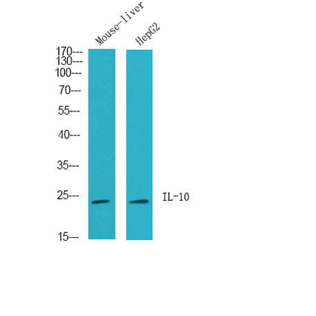Western Blot analysis of HepG2, Mouse liver cells using IL-10 Polyclonal Antibody. Secondary antibody was diluted at 1:20000
