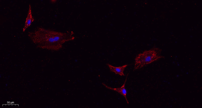 Immunofluorescence analysis of A549. 1,primary Antibody(red) was diluted at 1:200(4°C overnight). 2, Goat Anti Rabbit IgG (H&L) - Alexa Fluor 594 Secondary antibody was diluted at 1:1000(room temperature, 50min).3, Picture B: DAPI(blue) 10min.