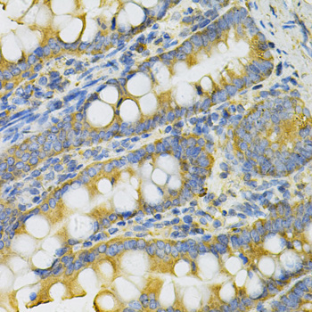 Immunohistochemistry analysis of paraffin-embedded Rat intestine using PGK1 Rabbit pAb at dilution of 1:100 (40x lens). Microwave antigen retrieval performed with 0.01M PBS Buffer (pH 7.2) prior to IHC staining.