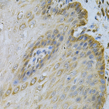 Immunohistochemistry analysis of paraffin-embedded Human esophagus using PGK1 Rabbit pAb at dilution of 1:100 (40x lens). Microwave antigen retrieval performed with 0.01M PBS Buffer (pH 7.2) prior to IHC staining.