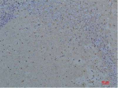 Immunohistochemical analysis of paraffin-embedded Rat Brain Tissue using S100 β Rabbit pAb diluted at 1:200.
