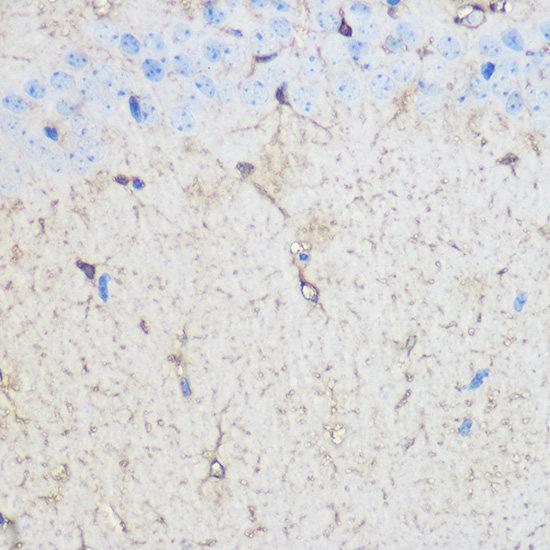 Immunohistochemistry analysis of paraffin-embedded Mouse brain using S100B Rabbit pAb at dilution of 1:100 (40x lens). Microwave antigen retrieval performed with 0.01M PBS Buffer (pH 7.2) prior to IHC staining.
