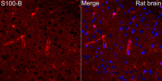 Immunofluorescence analysis of paraffin-embedded rat brain using S100B Rabbit pAb at dilution of 1:50 (40x lens). Secondary antibody: Cy3-conjugated Goat anti-Rabbit IgG (H+L) at 1:500 dilution. Blue: DAPI for nuclear staining. Perform microwave antigen retrieval with 0.01M citrate buffer (pH 6.0) prior to IF staining.