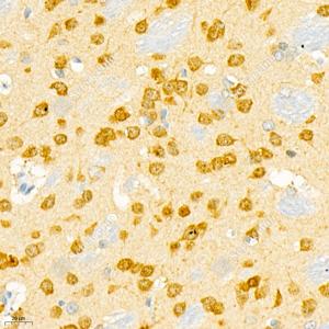 IHC analysis of Calbindin.Sample: Mouse brain, 4% PFA 12-24h.Antigen retrieval: Citrate buffer , 98℃, 20 min.Primary antibody: 1: 1000, 4℃ overnight.Secondary antibody: HRP conjugated Goat Anti-Rabbit lgG , 1: 200, RT, 1h.