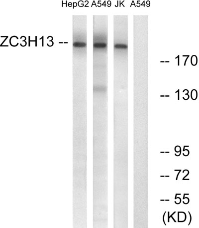 Western blot analysis of lysates from A549, Jurkat, HepG2 cells, using ZC3H13 Polyclonal Antibody. The lane on the right is blocked with the synthesized peptide.