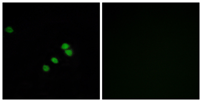 Immunofluorescence analysis of HepG2 cells, using SP1 Antibody. The picture on the right is blocked with the synthesized peptide.