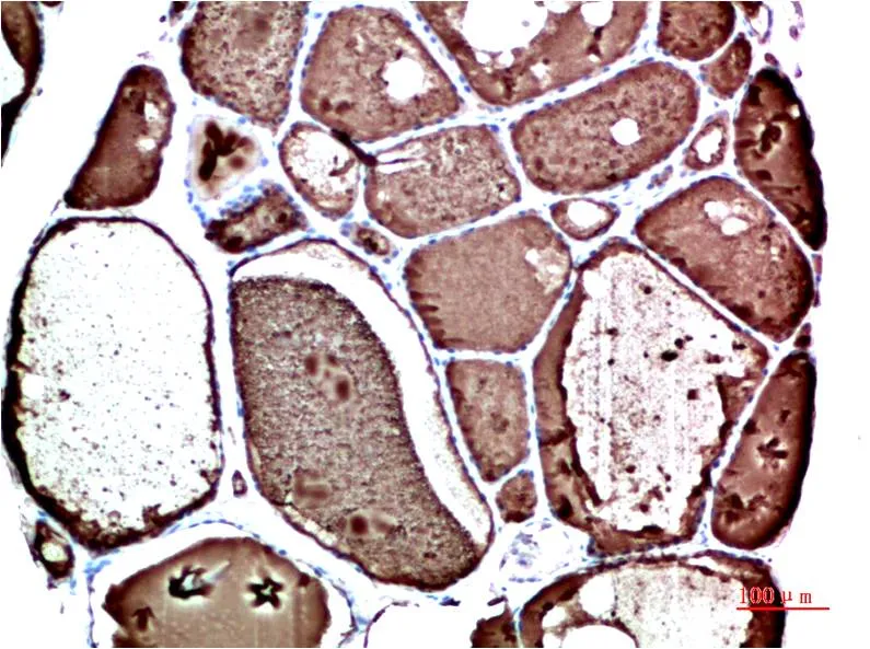 Immunohistochemical analysis of paraffin-embedded Human tonsils using Prealbumin (CL0290) antibody.High-pressure and temperature Sodium Citrate pH 6.0 was used for antigen retrieval.