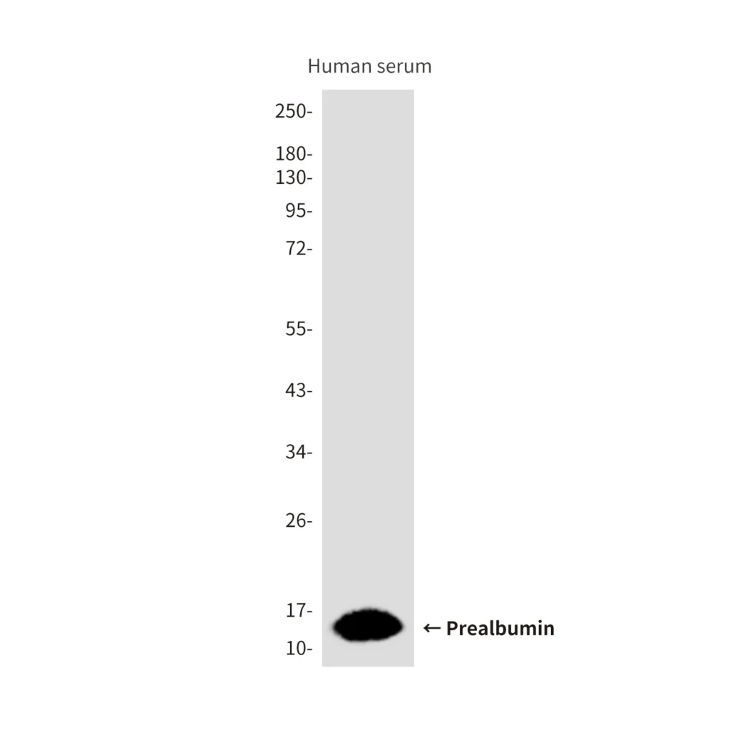 Western blot analysis of Prealbumin (CL0290) in Hela, Jurkat, mouse brain, MOLT4, Human serum lysates using Prealbumin (CL0290) antibody