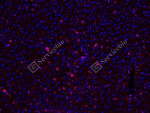 IF analysis ofbeta Actinred.Sample: Rat liver, 4% PFA 12-24h.Antigen retrieval: Tris-EDTA buffer , 98℃, 20min.Blocking buffer: 3% BSA in PBS, RT, 30min.Primary antibody: 1: 1000, 4℃ overnight.Secondary antibody: Cy3 conjugated Goat Anti-Rabbit IgG , 1: 300, RT, 1h.