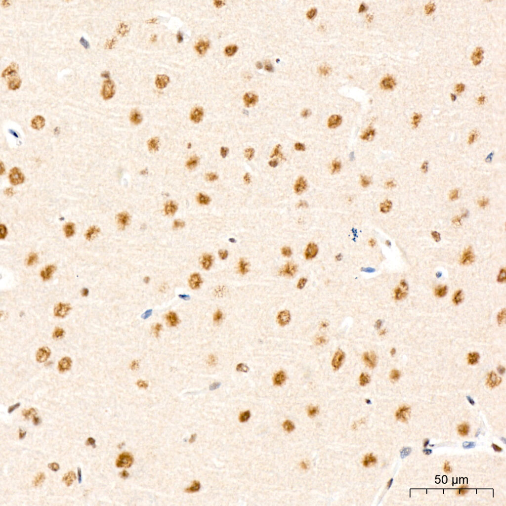 Immunohistochemistry analysis of paraffin-embedded Mouse brain tissue using Phospho-Akt-S473 Rabbit mAb at a dilution of 1:200 . High pressure antigen retrieval performed with 0.01M Citrate Bufferr prior to IHC staining.