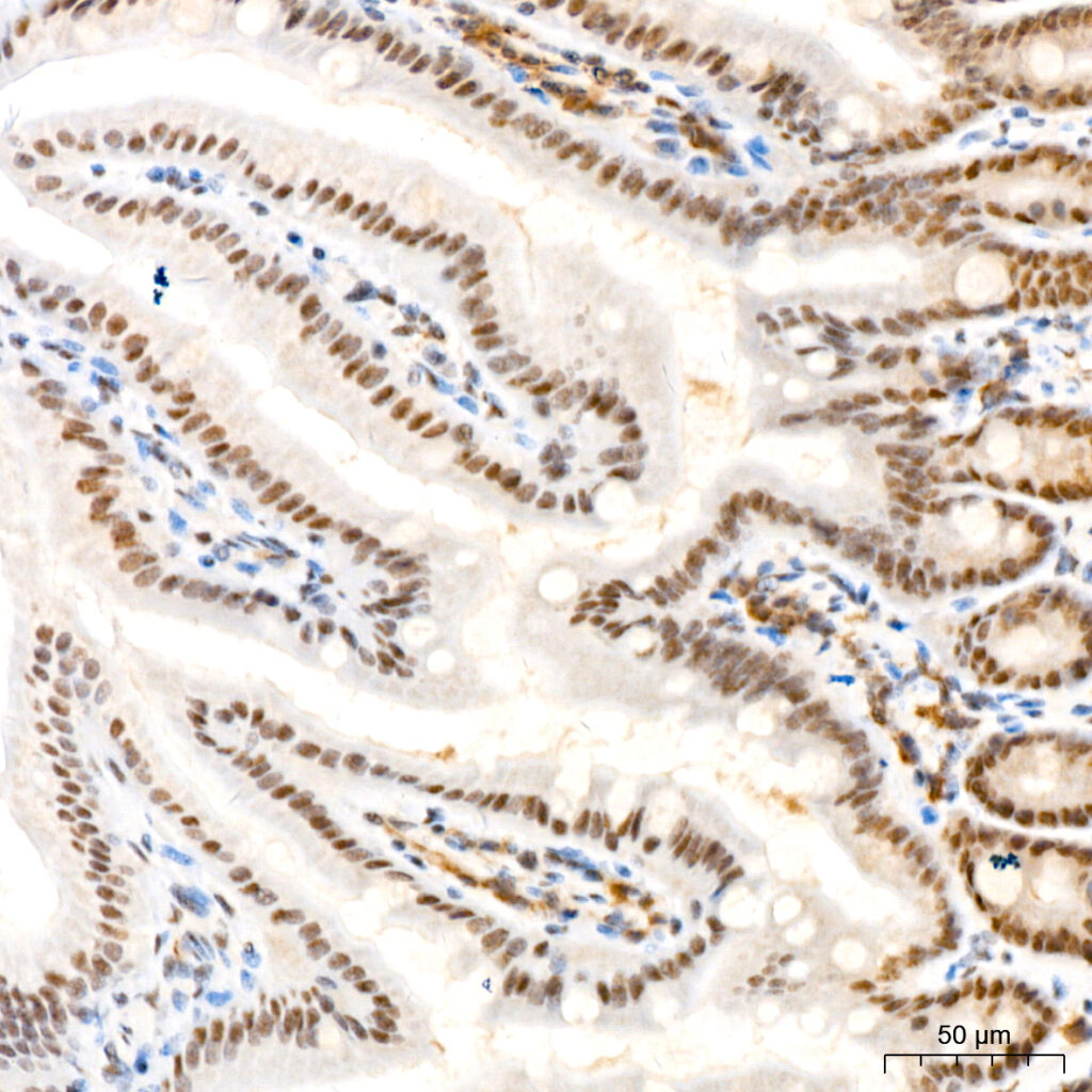 Immunohistochemistry analysis of paraffin-embedded Mouse colon tissue using Phospho-Akt-S473 Rabbit mAb at a dilution of 1:200 . High pressure antigen retrieval performed with 0.01M Citrate Bufferr prior to IHC staining.