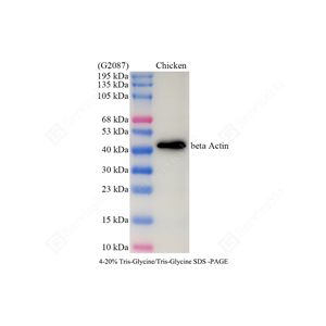 WB analysis of beta Actin . Sample: Protein treated by RIPA Lysis Buffer . Blocking buffer: 3% Nonfat dry milk in TBST, RT, 1h. Primary antibody: 1: 5000, 4℃ overnight. Secondary antibody: HRP Goat Anti-Rabbit lgG , 1: 5000, RT, 1h.