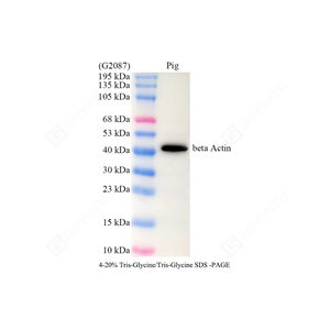 WB analysis of beta Actin . Sample: Protein treated by RIPA Lysis Buffer . Blocking buffer: 3% Nonfat dry milk in TBST, RT, 1h. Primary antibody: 1: 5000, 4℃ overnight. Secondary antibody: HRP Goat Anti-Rabbit lgG , 1: 5000, RT, 1h.