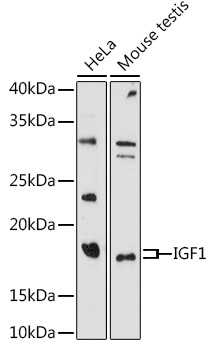 Western blot analysis of various lysates using IGF1 Rabbit pAb (A0303) at 1:1000 dilution. Secondary antibody: HRP-conjugated Goat anti-Rabbit IgG (H+L) (AS014) at 1:10000 dilution. Lysates/proteins: 25μg per lane. Blocking buffer: 3% nonfat dry milk in TBST. Detection: ECL Basic Kit (RM00020). Exposure time: 180s.