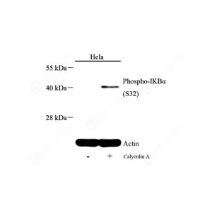 WB analysis of Phospho-IKB alpha.Sample: Protein treated by RIPA Lysis Buffer .Blocking buffer: 3% Nonfat dry milk in TBST, RT, 1h.Primary antibody: 1: 500, 4℃ overnight.Secondary antibody: HRP conjugated Goat Anti-Rabbit lgG , 1: 5000, RT, 1h.