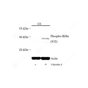 WB analysis of Phospho-IKB alpha.Sample: Protein treated by RIPA Lysis Buffer .Blocking buffer: 3% Nonfat dry milk in TBST, RT, 1h.Primary antibody: 1: 500, 4℃ overnight.Secondary antibody: HRP conjugated Goat Anti-Rabbit lgG , 1: 5000, RT, 1h.