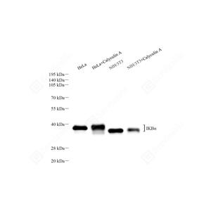WB analysis of IKB alpha.Sample: Protein treated by RIPA Lysis Buffer .Blocking buffer: 3% Nonfat dry milk in TBST, RT, 1h.Primary antibody: 1: 1000, 4℃ overnight.Secondary antibody: HRP conjugated Goat Anti-Mouse lgG , 1: 5000, RT, 1h.