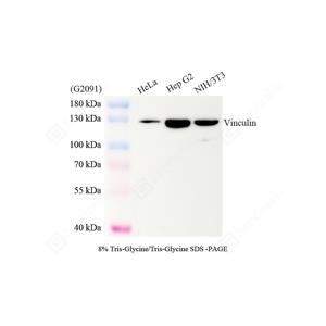 WB analysis of Vinculin.Sample: Protein treated by RIPA Lysis Buffer .Blocking buffer: 3% Nonfat dry milk in TBST, RT, 1h.Primary antibody: 1: 1000, 4℃ overnight.Secondary antibody: HRP conjugated Goat Anti-Mouse lgG , 1: 5000, RT, 1h.
