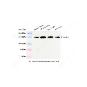 WB analysis of Vinculin.Sample: Protein treated by RIPA Lysis Buffer .Blocking buffer: 3% Nonfat dry milk in TBST, RT, 1h.Primary antibody: 1: 1000, 4℃ overnight.Secondary antibody: HRP conjugated Goat Anti-Mouse lgG , 1: 5000, RT, 1h.