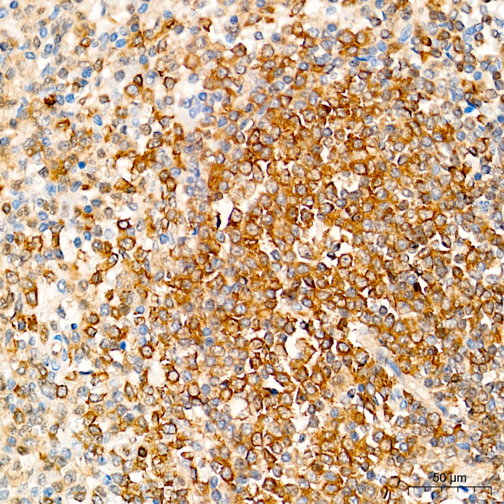 Immunohistochemistry analysis of paraffin-embedded Human spleen tissue using NFKB1 Rabbit mAb at a dilution of 1:200 (40x lens). High pressure antigen retrieval performed with 0.01M Tris-EDTA Buffer (pH 9.0) prior to IHC staining.