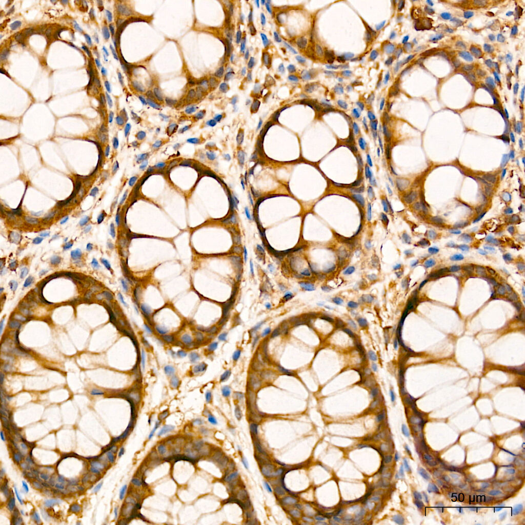 Immunohistochemistry analysis of paraffin-embedded Human colon tissue using NFKB1 Rabbit mAb at a dilution of 1:200 (40x lens). High pressure antigen retrieval performed with 0.01M Tris-EDTA Buffer (pH 9.0) prior to IHC staining.
