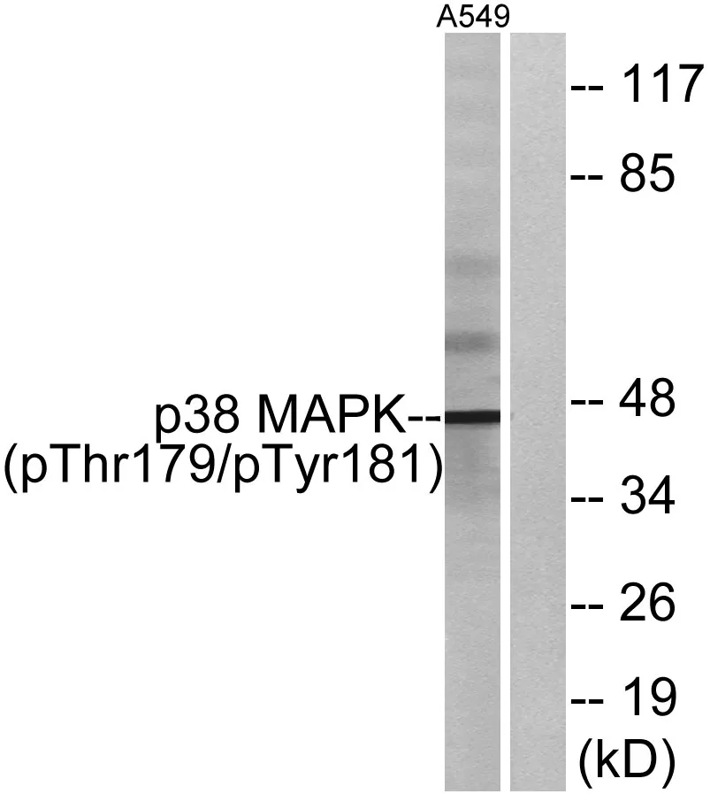 Immunofluorescence analysis of mouse-liver tissue. 1,p38 （ phospho Thr180/Y182） Polyclonal Antibody（red） was diluted at 1:200（4°C,overnight）. 2, Cy3 labled Secondary antibody was diluted at 1:300（room temperature, 50min）. 3, Picture B: DAPI（blue） 10min. Picture A:Target. Picture B: DAPI. Picture C: merge of A+B