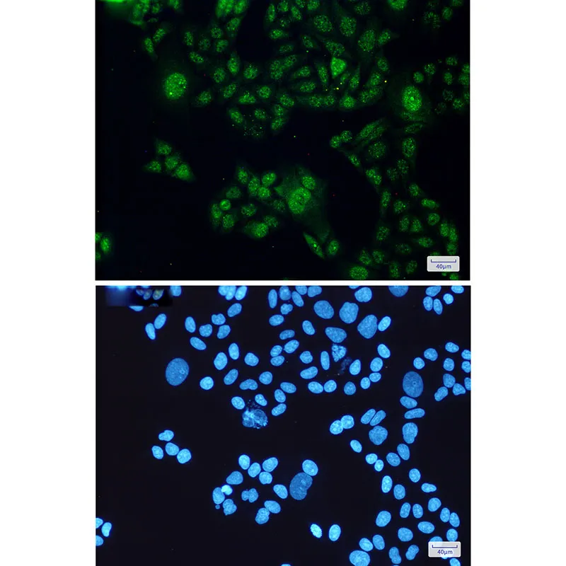 Immunocytochemistry analysis of STAT3(green) in Hela using STAT3 antibody,and DAPI(blue)