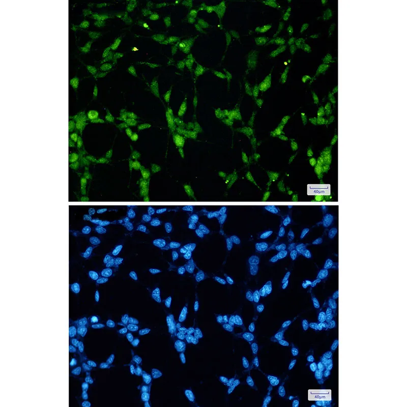 Immunocytochemistry analysis of TDP 43 (green) in 293t using TDP 43 antibody,and DAPI(blue).