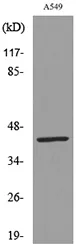 Western blot analysis of lysate from A549 cells, using KRT19 Antibody.