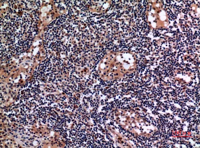 Immunohistochemical analysis of paraffin-embedded human-lymph-gland, antibody was diluted at 1:100