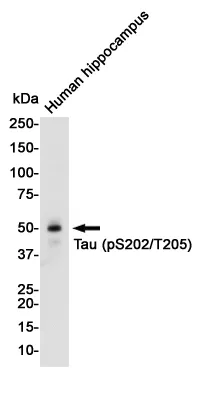 Western blot analysis of Tau (Phospho-Ser202/Thr205) in Human Fetal brain lysates using Phospho-Tau (Ser202/Thr205) antibody.