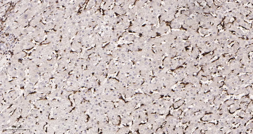 Immunohistochemical analysis of paraffin-embedded Human liver tissue. 1, Iba1 Rabbit Monoclonal Antibody was diluted at 1:200(4°C,overnight). 2, EDTA pH 9.0 was used for antibody retrieval(>98°C,20min). 3,Secondary antibody was diluted at 1:200(room temperature, 30min).